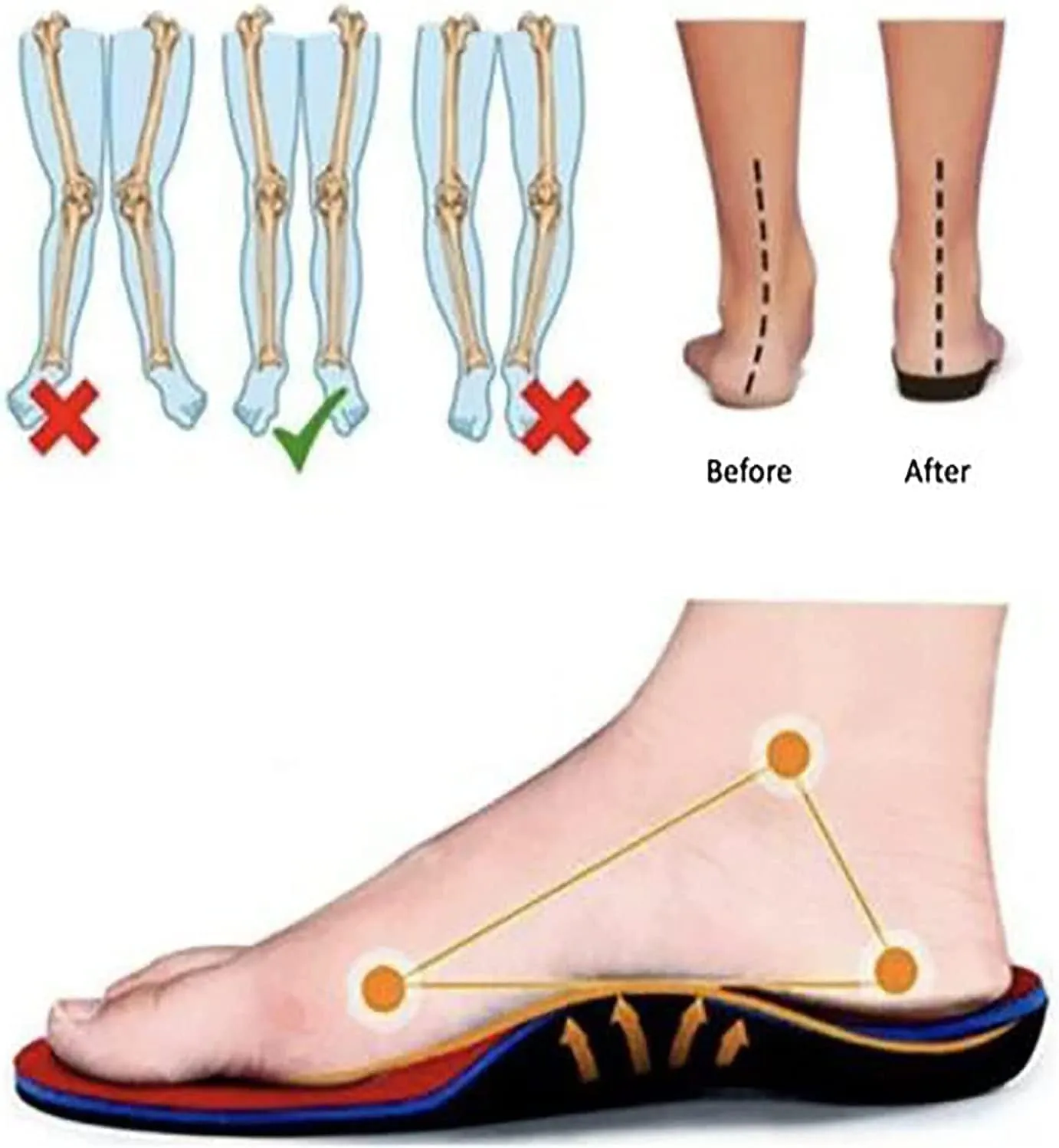 Orthopedic Walking Shoes for Women, Slip-On Light Air Cushion Mesh Up Stretch Platform Orthopedic Sneakers for Arch Support